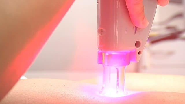 consejos-para-tener-una-depilacion-laser-segura-en-verano